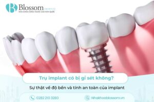 Trụ implant có bị gỉ sét không? Sự thật về độ bền và tính an toàn của implant