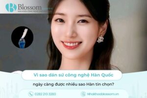 Vì sao dán sứ công nghệ Hàn Quốc ngày càng được nhiều sao Hàn tin chọn?