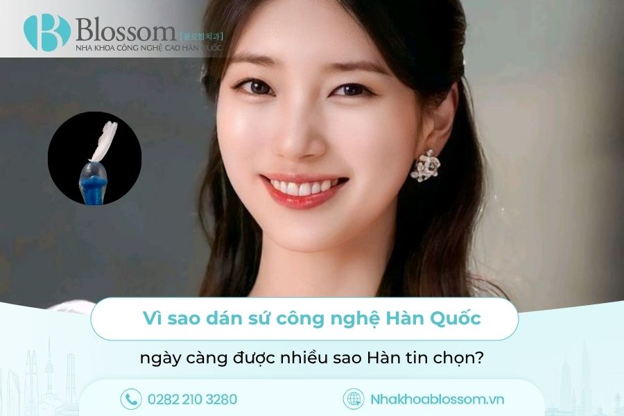 Vì sao dán sứ công nghệ Hàn Quốc ngày càng được nhiều sao Hàn tin chọn?