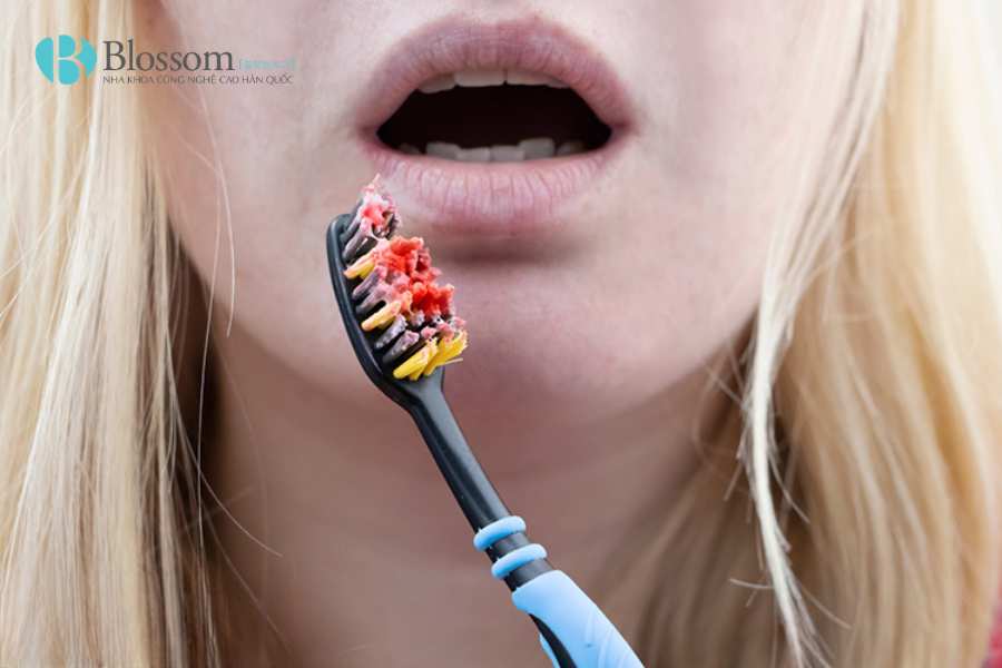 Đánh răng bị chảy máu có nguy hiểm không? Những vấn đề răng miệng cần cảnh giác 3 danh rang bi chay mau 3