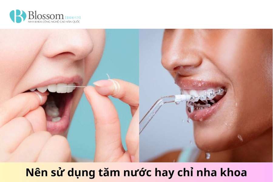 Đắp răng sứ là gì? Trường hợp nào nên thực hiện và những điều cần biết 4 dap rang su 5