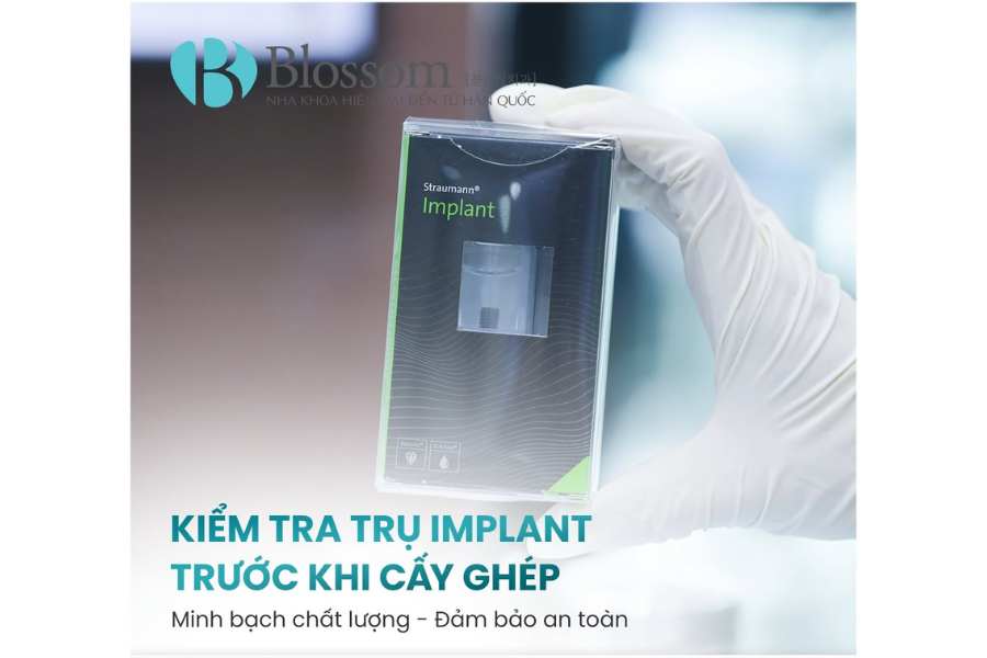 Trụ implant có bị gỉ sét không? Sự thật về độ bền và tính an toàn của implant 4 tru implant co bi gi set 4