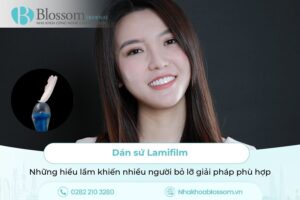 Dán sứ Lamifilm: Những hiểu lầm khiến nhiều người bỏ lỡ giải pháp phù hợp