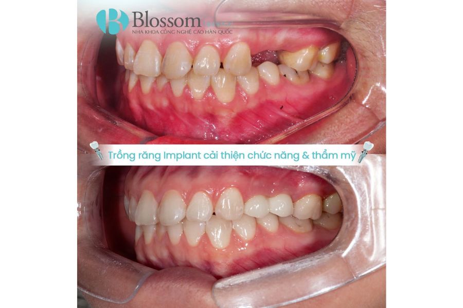 mang huong dan phau thuat 3d 3