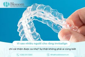 Vì sao nhiều người cho rằng Invisalign chỉ cải thiện được ca nhẹ? Sự thật không phải ai cũng biết