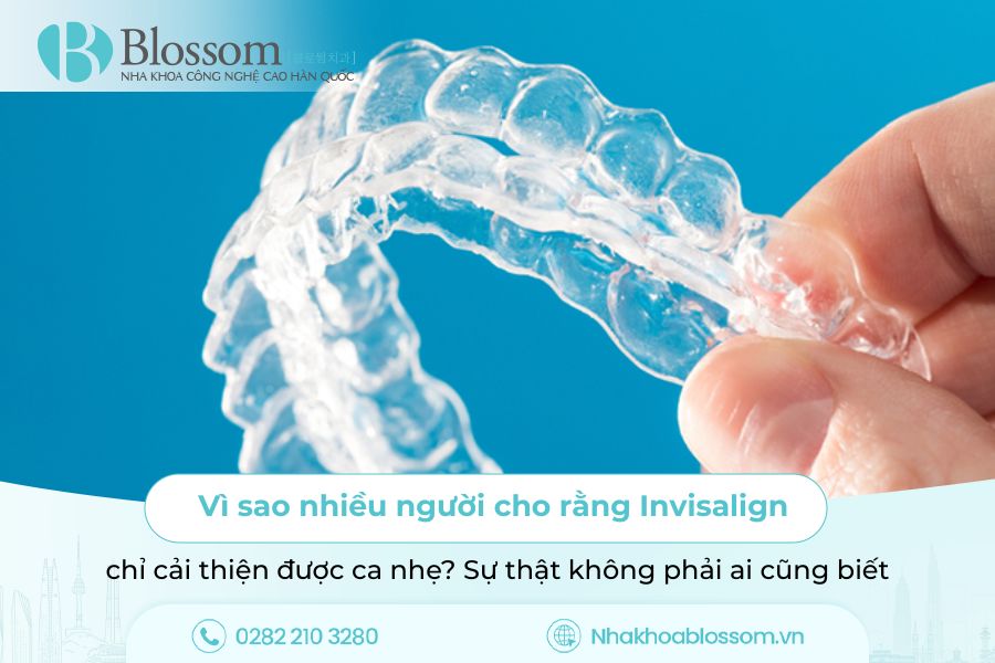 Vì sao nhiều người cho rằng Invisalign chỉ cải thiện được ca nhẹ? Sự thật không phải ai cũng biết